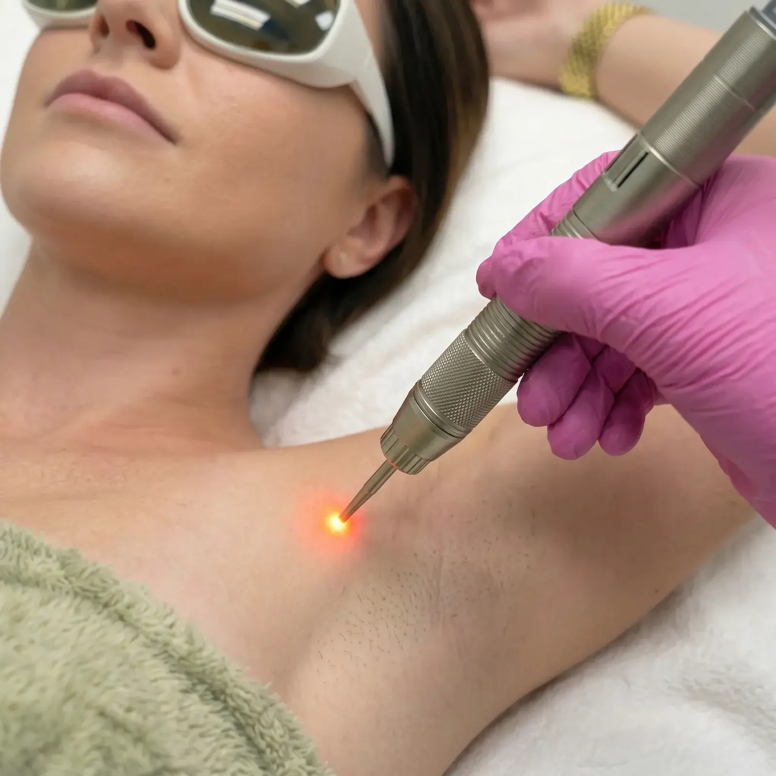 Close-up of a woman in white laser safety goggles lying back on a white towel while a hand in a pink glove holds a metal laser handpiece with an orange aiming light against the skin of her underarm