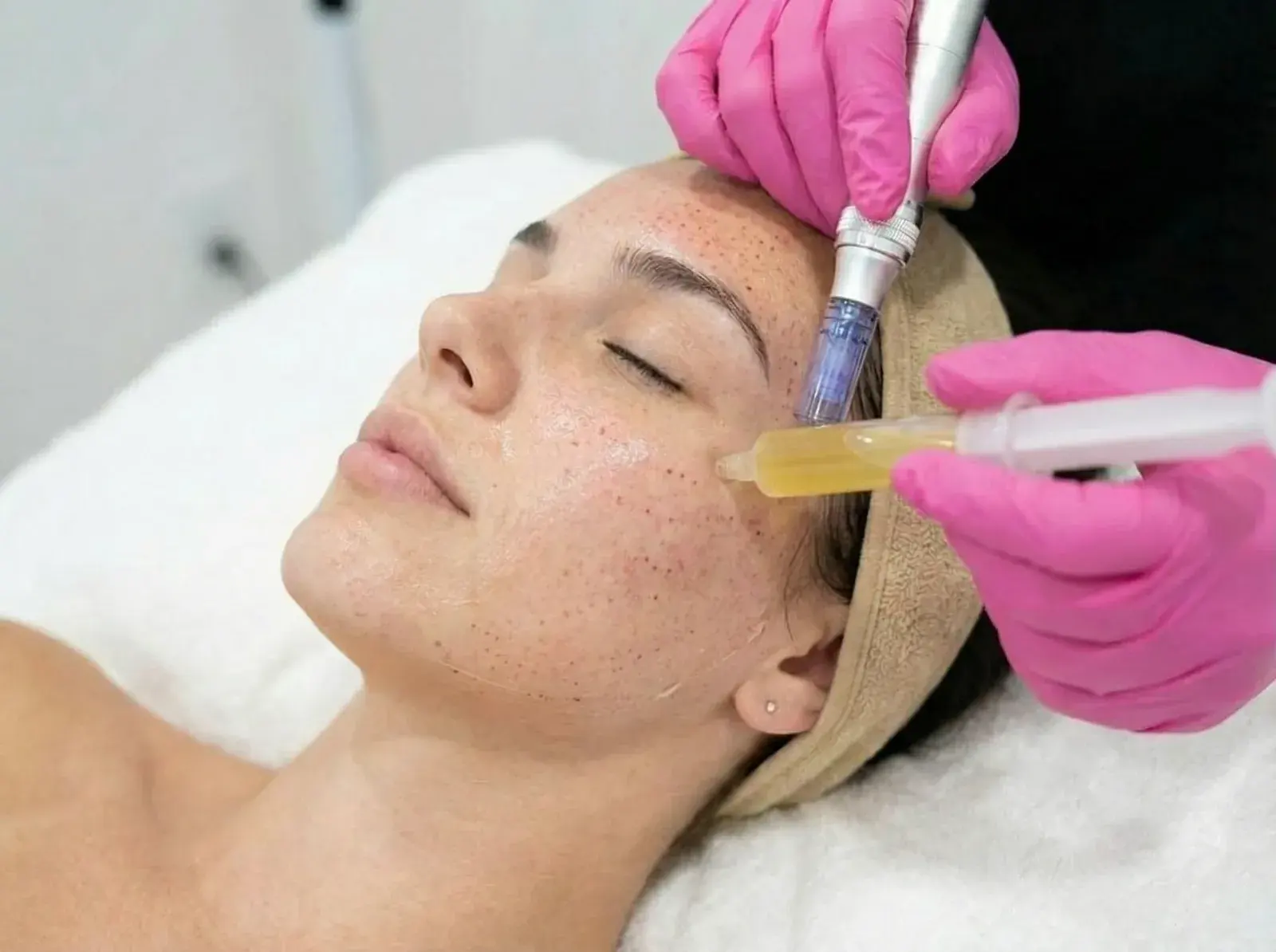 PRP Vampire Facial