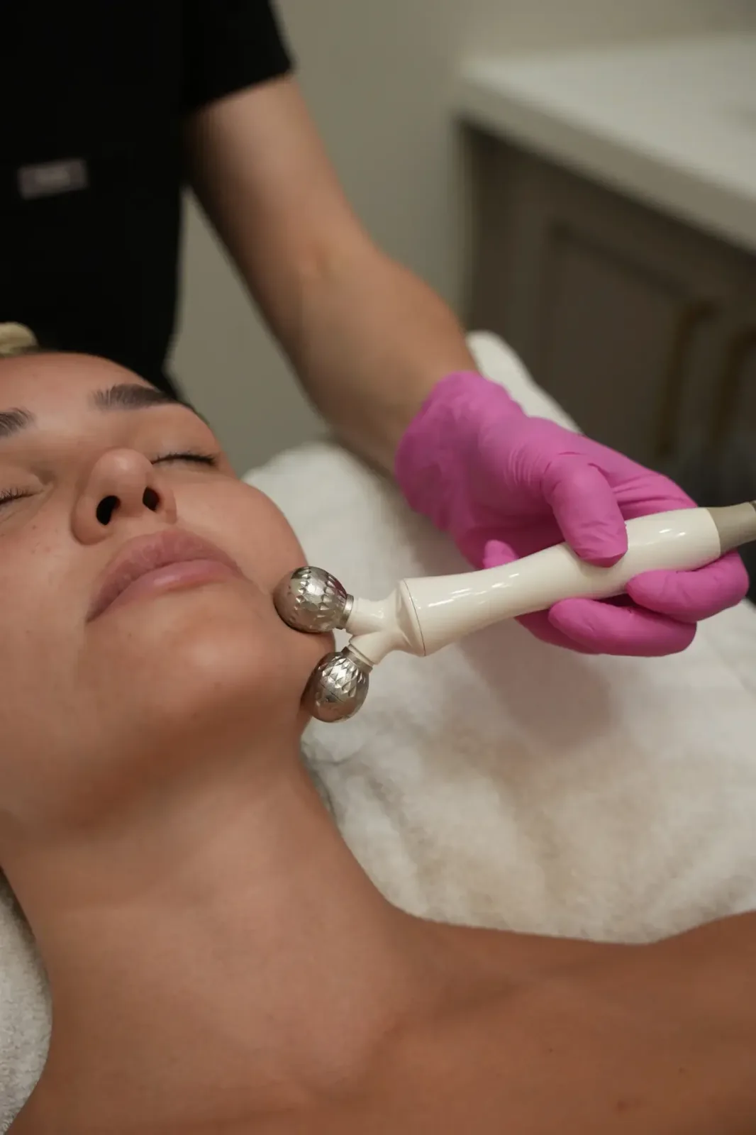 microdermabrasion pickering