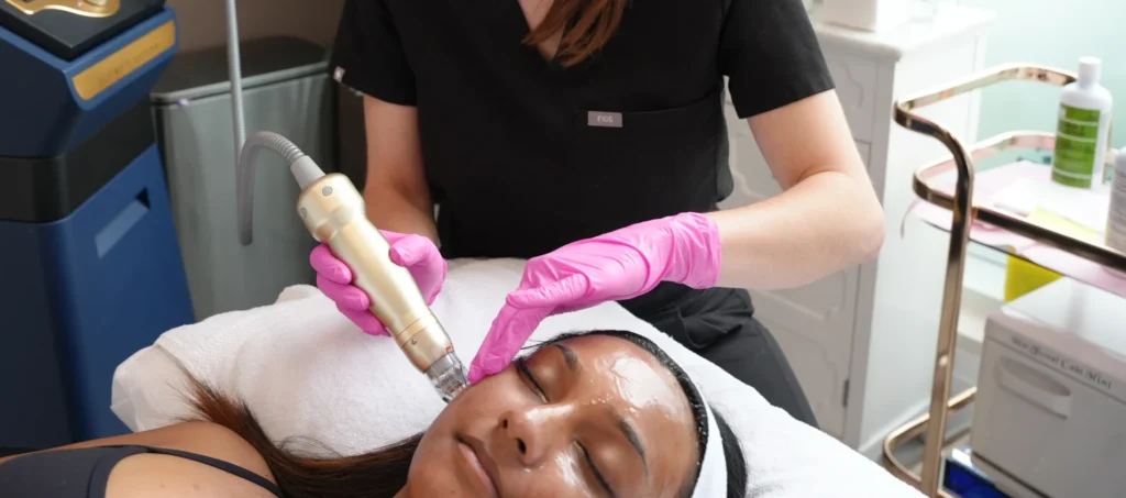 Rf Microneedling