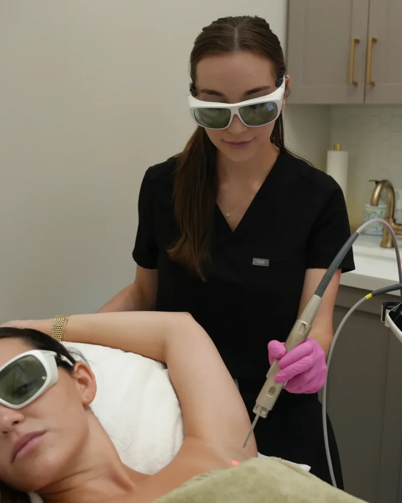 laser hair removal